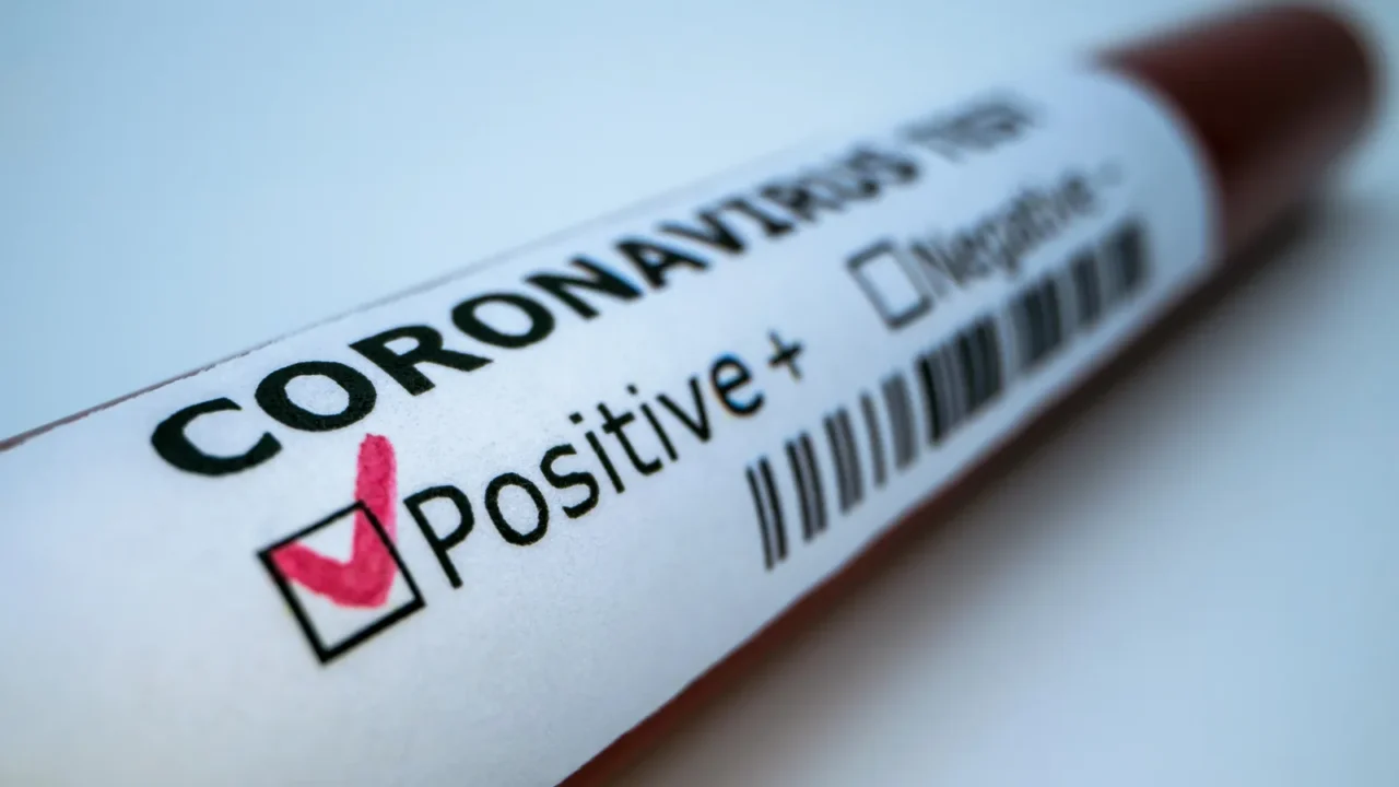 positive covid19 test and laboratory sample of blood testing for